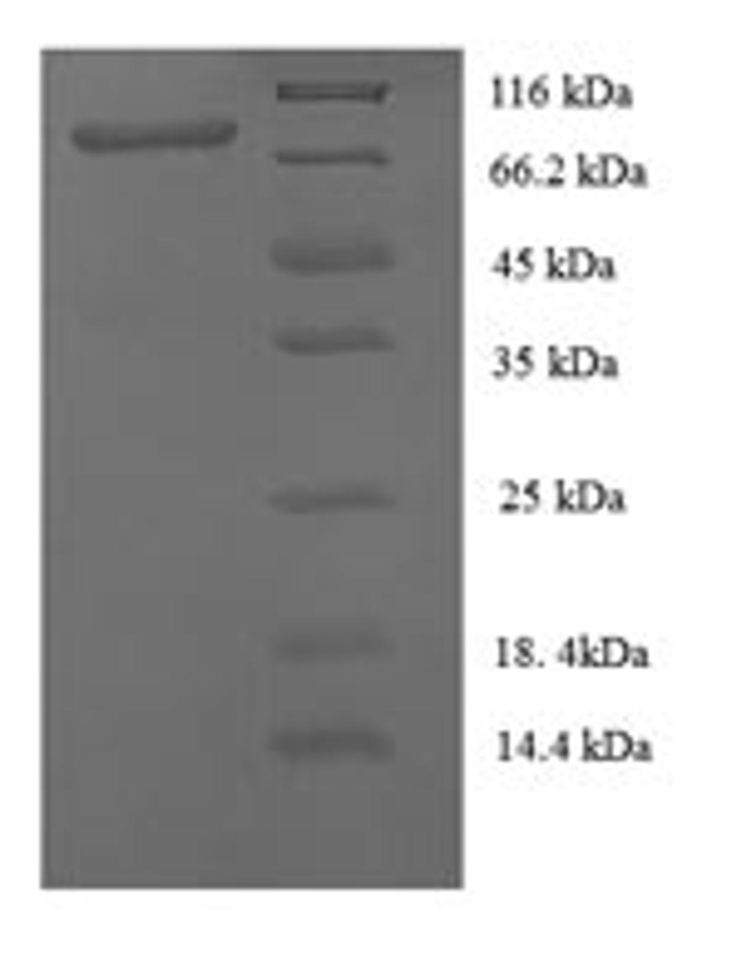 (Tris-Glycine gel) Discontinuous SDS-PAGE (reduced) with 5% enrichment gel and 15% separation gel.
