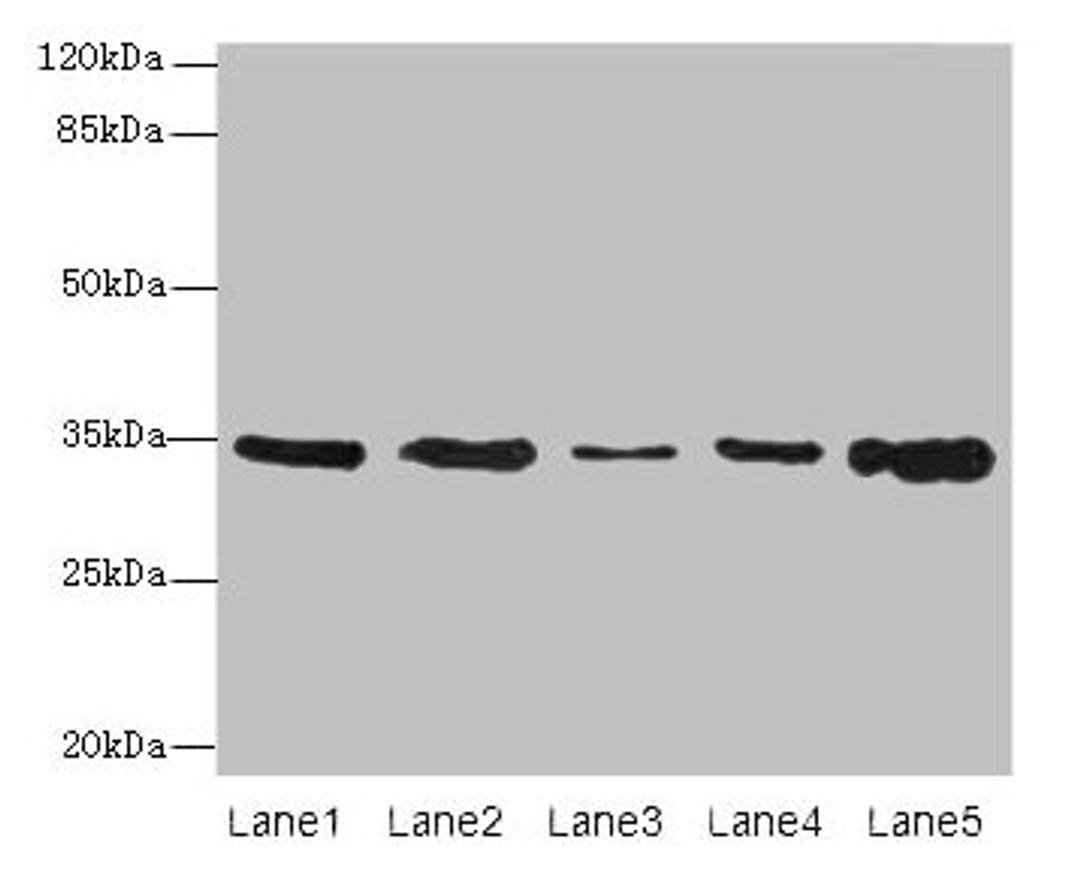 Western blot. All lanes: UCP3 antibody at 0.9µg/ml. Lane 1: Jurkat whole cell lysate. Lane 2: SH-SY5Y whole cell lysate. Lane 3: U251 whole cell lysate. Lane 4: A549 whole cell lysate. Lane 5: Hela whole cell lysate. Secondary. Goat polyclonal to rabbit IgG at 1/10000 dilution. Predicted band size: 35, 30, 23 kDa. Observed band size: 35 kDa