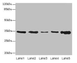 Western blot. All lanes: UCP3 antibody at 0.9µg/ml. Lane 1: Jurkat whole cell lysate. Lane 2: SH-SY5Y whole cell lysate. Lane 3: U251 whole cell lysate. Lane 4: A549 whole cell lysate. Lane 5: Hela whole cell lysate. Secondary. Goat polyclonal to rabbit IgG at 1/10000 dilution. Predicted band size: 35, 30, 23 kDa. Observed band size: 35 kDa