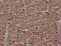 IHC image of CSB-PA018035LA01HU diluted at 1:100 and staining in paraffin-embedded human heart tissue performed on a Leica BondTM system. After dewaxing and hydration, antigen retrieval was mediated by high pressure in a citrate buffer (pH 6.0). Section was blocked with 10% normal goat serum 30min at RT. Then primary antibody (1% BSA) was incubated at 4°C overnight. The primary is detected by a biotinylated secondary antibody and visualized using an HRP conjugated SP system.