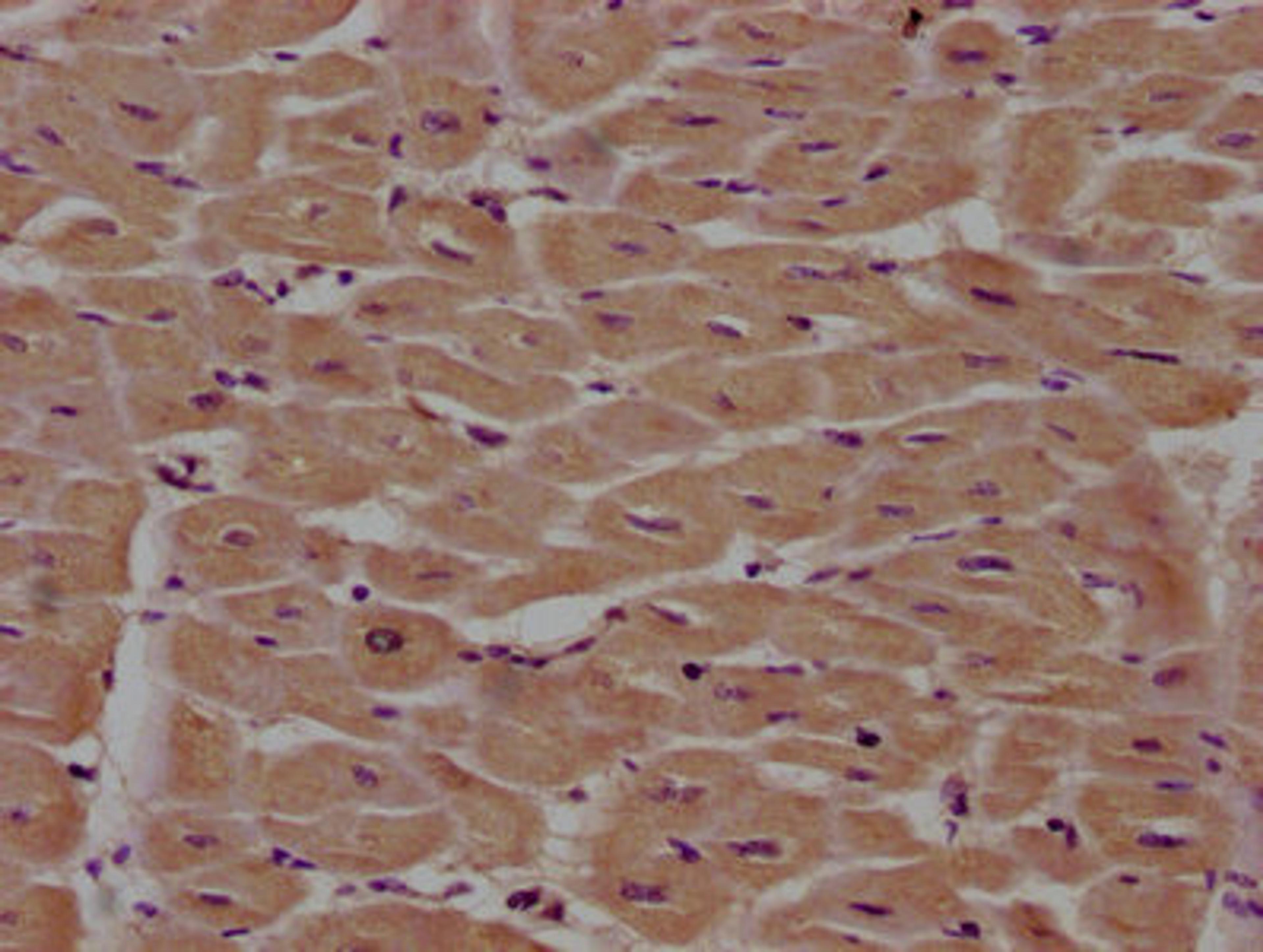 IHC image of CSB-PA018035LA01HU diluted at 1:100 and staining in paraffin-embedded human heart tissue performed on a Leica BondTM system. After dewaxing and hydration, antigen retrieval was mediated by high pressure in a citrate buffer (pH 6.0). Section was blocked with 10% normal goat serum 30min at RT. Then primary antibody (1% BSA) was incubated at 4°C overnight. The primary is detected by a biotinylated secondary antibody and visualized using an HRP conjugated SP system.