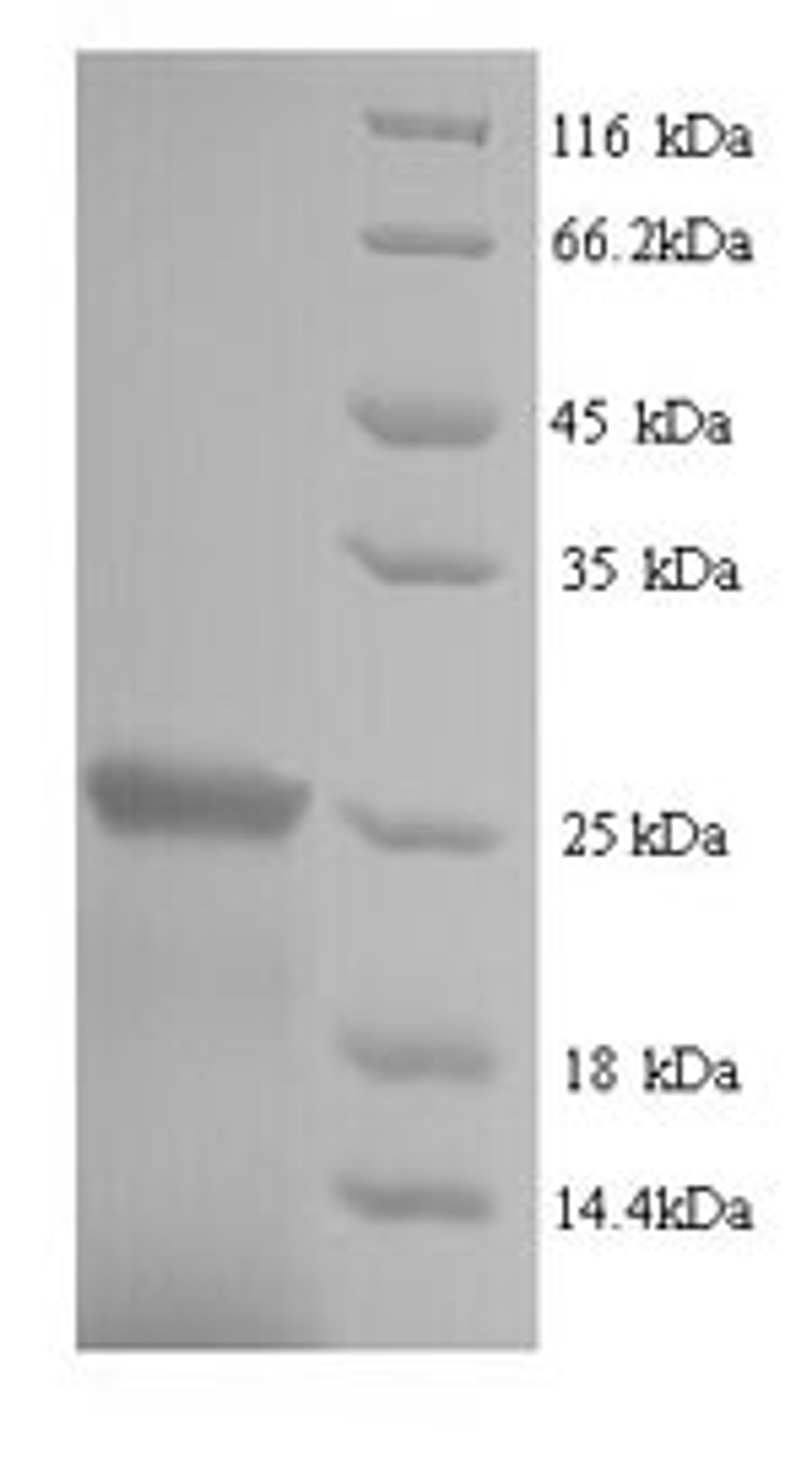 (Tris-Glycine gel) Discontinuous SDS-PAGE (reduced) with 5% enrichment gel and 15% separation gel.