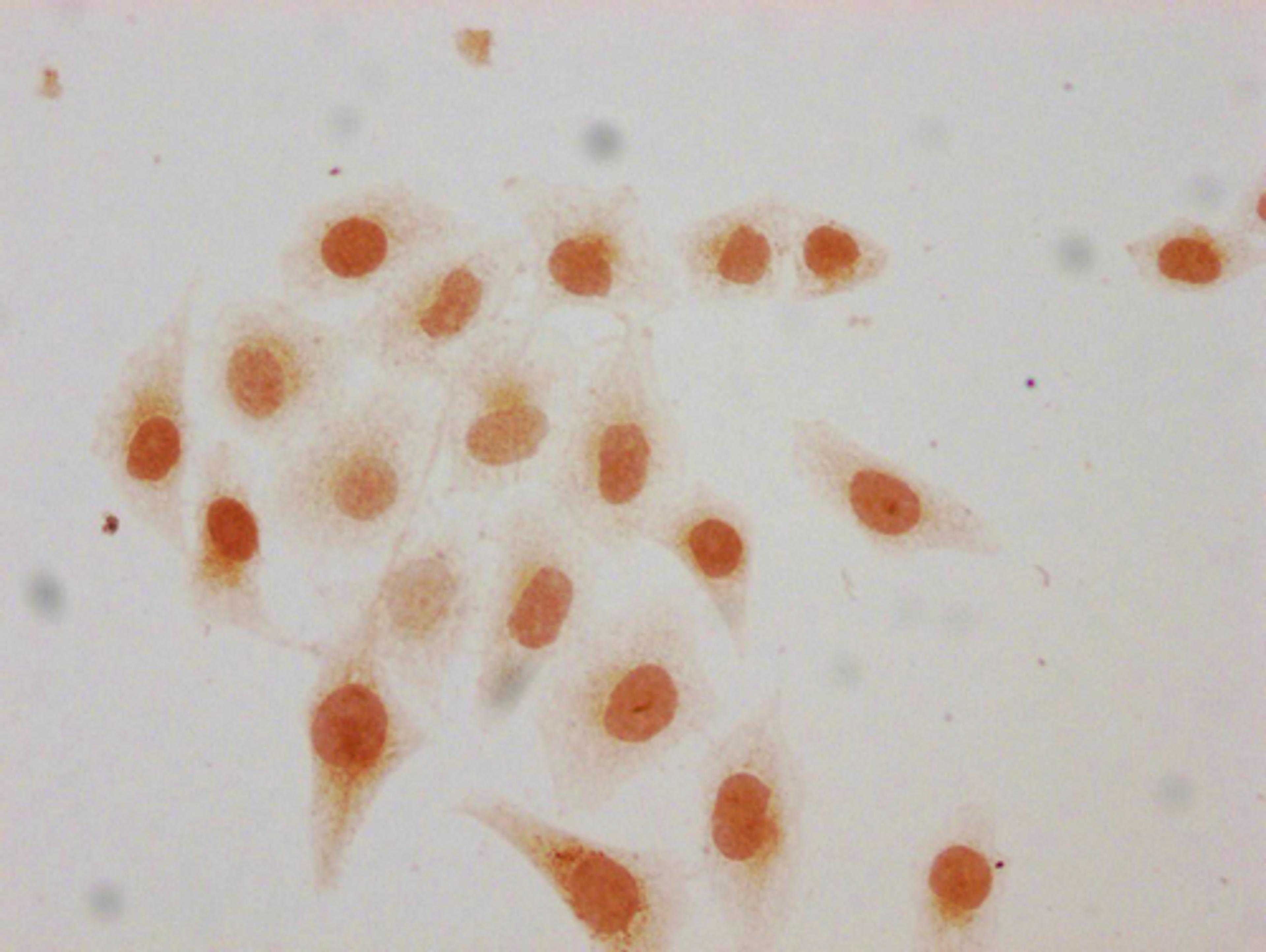 Immunocytochemistry analysis of CSB-PA010418PA115acHU diluted at 1:20 and staining in Hela cells(treated with 30mM sodium butyrate for 4h) performed on a Leica BondTM system. The cells were fixed in 4% formaldehyde, permeabilized using 0.2% Triton X-100 and blocked with 10% normal goat serum 30min at RT. Then primary antibody (1% BSA) was incubated at 4°C overnight. The primary is detected by a biotinylated secondary antibody and visualized using an HRP conjugated SP system.