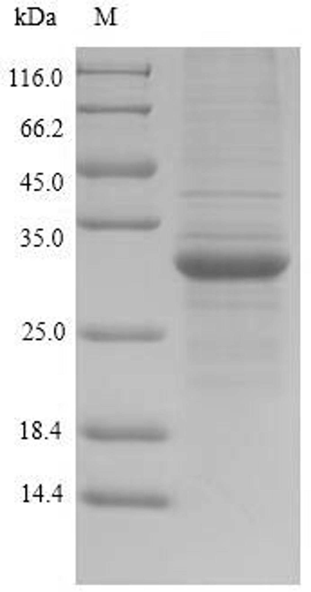 (Tris-Glycine gel) Discontinuous SDS-PAGE (reduced) with 5% enrichment gel and 15% separation gel.