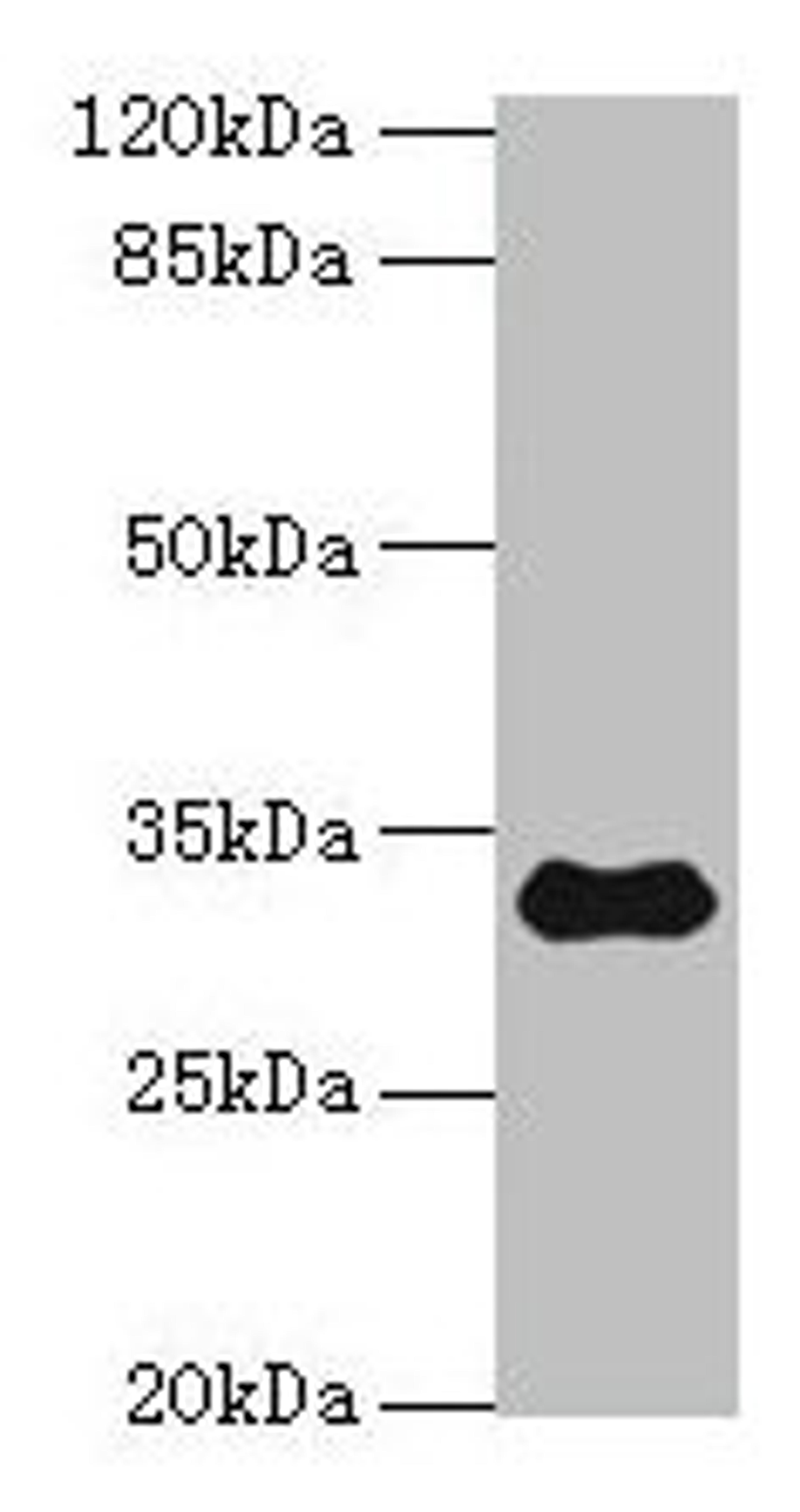 Western blot. All lanes: TMEM53 antibody at 5µg/ml + Mouse brain tissue. Secondary. Goat polyclonal to rabbit IgG at 1/10000 dilution. Predicted band size: 32, 24 kDa. Observed band size: 32 kDa