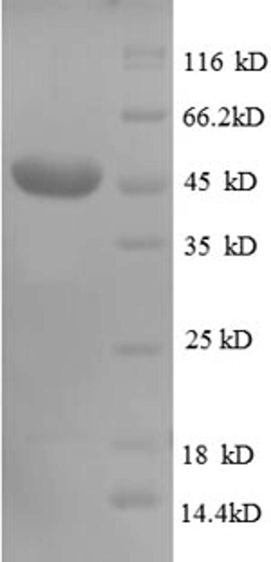 (Tris-Glycine gel) Discontinuous SDS-PAGE (reduced) with 5% enrichment gel and 15% separation gel.