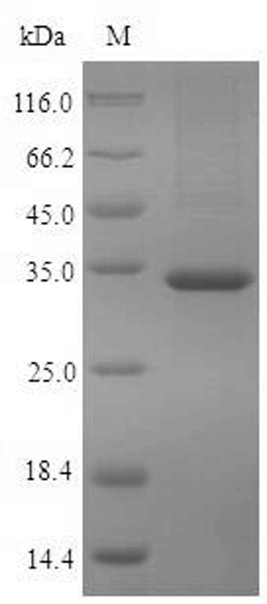 (Tris-Glycine gel) Discontinuous SDS-PAGE (reduced) with 5% enrichment gel and 15% separation gel.