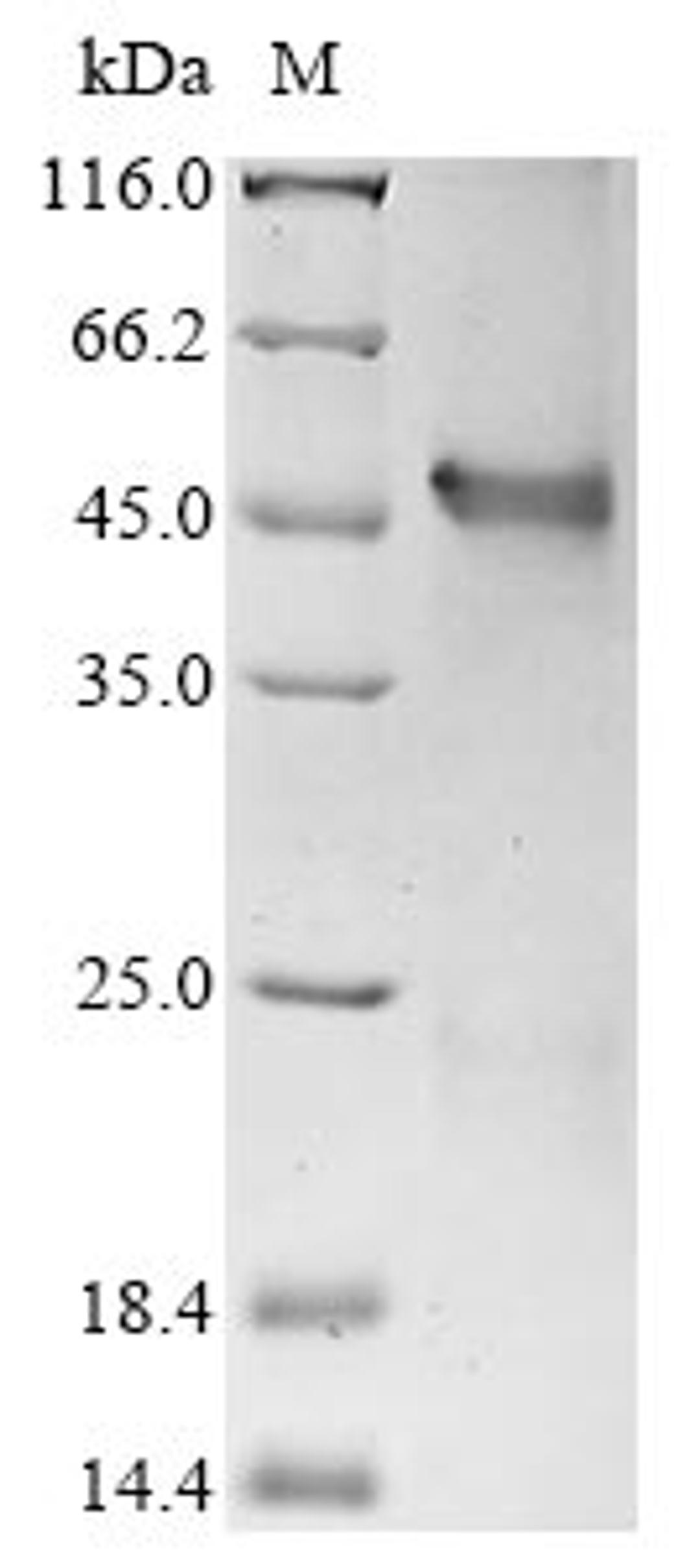 (Tris-Glycine gel) Discontinuous SDS-PAGE (reduced) with 5% enrichment gel and 15% separation gel.