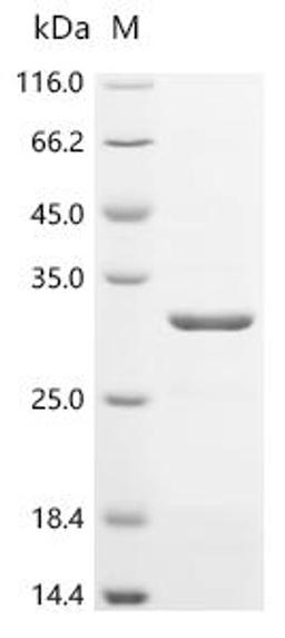 (Tris-Glycine gel) Discontinuous SDS-PAGE (reduced) with 5% enrichment gel and 15% separation gel.