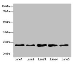 Western blot. All lanes: RAB9A antibody at 7.66µg/ml. Lane 1: Jurkat whole cell lysate. Lane 2: K562 whole cell lysate. Lane 3: HepG2 whole cell lysate. Lane 4: 293T whole cell lysate. Lane 5: Hela whole cell lysate. Secondary. Goat polyclonal to rabbit IgG at 1/10000 dilution. Predicted band size: 23 kDa. Observed band size: 23 kDa