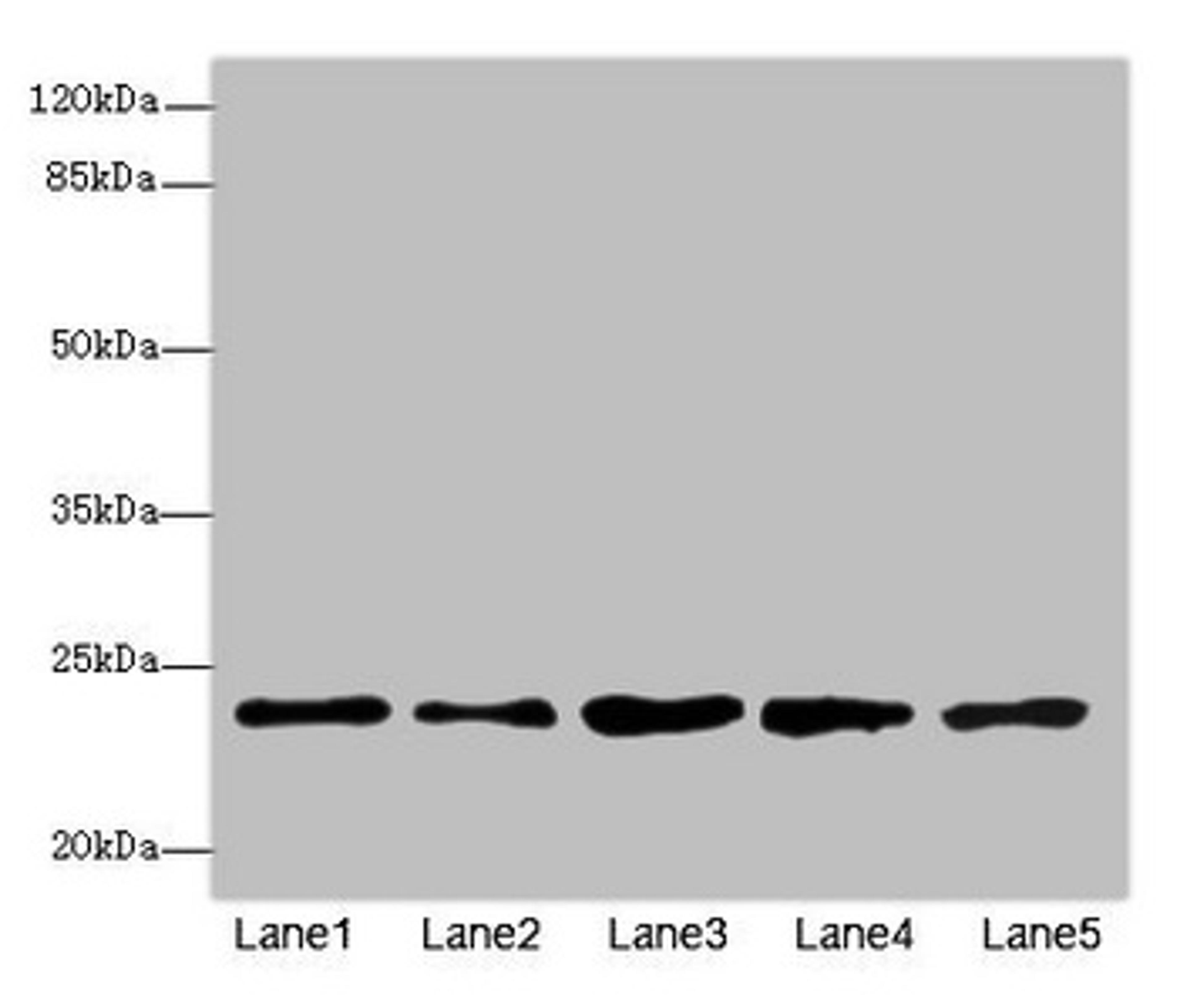 Western blot. All lanes: RAB9A antibody at 7.66µg/ml. Lane 1: Jurkat whole cell lysate. Lane 2: K562 whole cell lysate. Lane 3: HepG2 whole cell lysate. Lane 4: 293T whole cell lysate. Lane 5: Hela whole cell lysate. Secondary. Goat polyclonal to rabbit IgG at 1/10000 dilution. Predicted band size: 23 kDa. Observed band size: 23 kDa