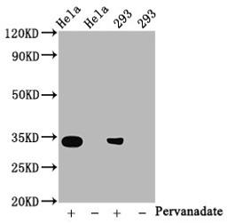 Western Blot. Positive WB detected in:Hela whole cell lysate, 293 whole cell lysate(treated with Pervanadate or not). All lanes:Phospho-CDK2 antibody at 0.8μg/ml. Secondary. Goat polyclonal to rabbit IgG at 1/50000 dilution. Predicted band size: 34 KDa. Observed band size: 34 KDa.