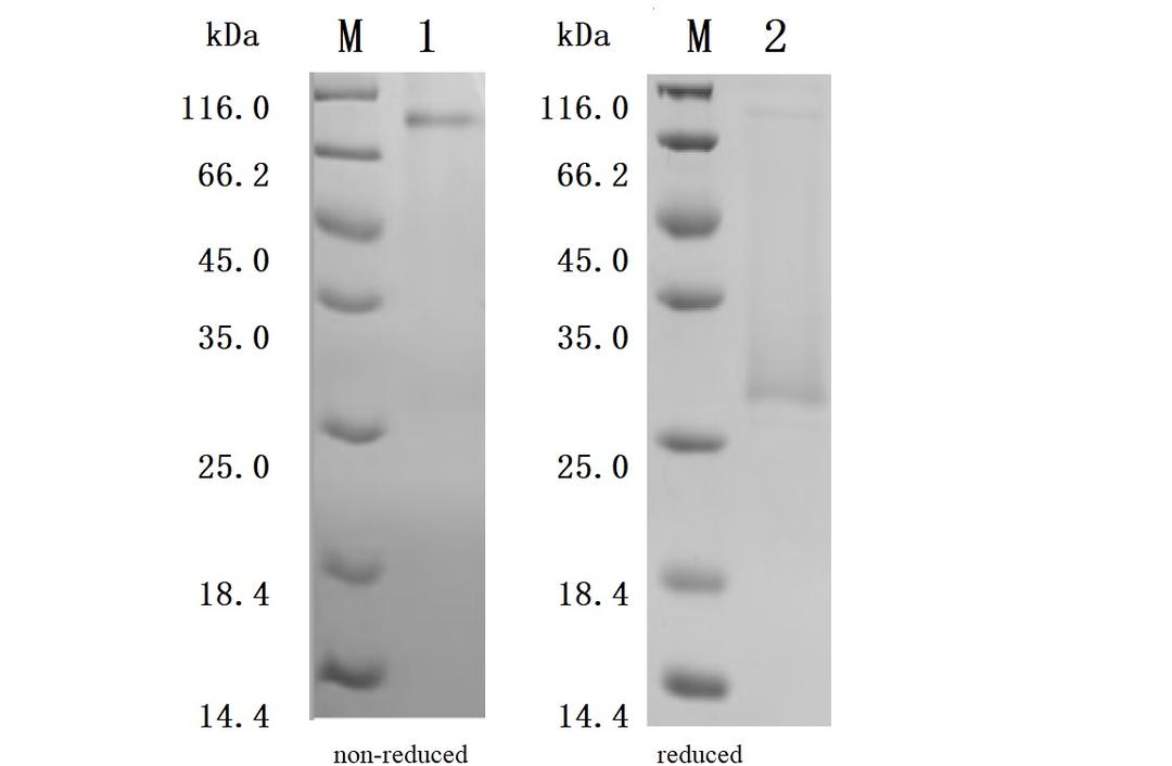 (Tris-Glycine gel) Discontinuous SDS-PAGE (reduced/non-reduced) with 5% enrichment gel and 15% separation gel.