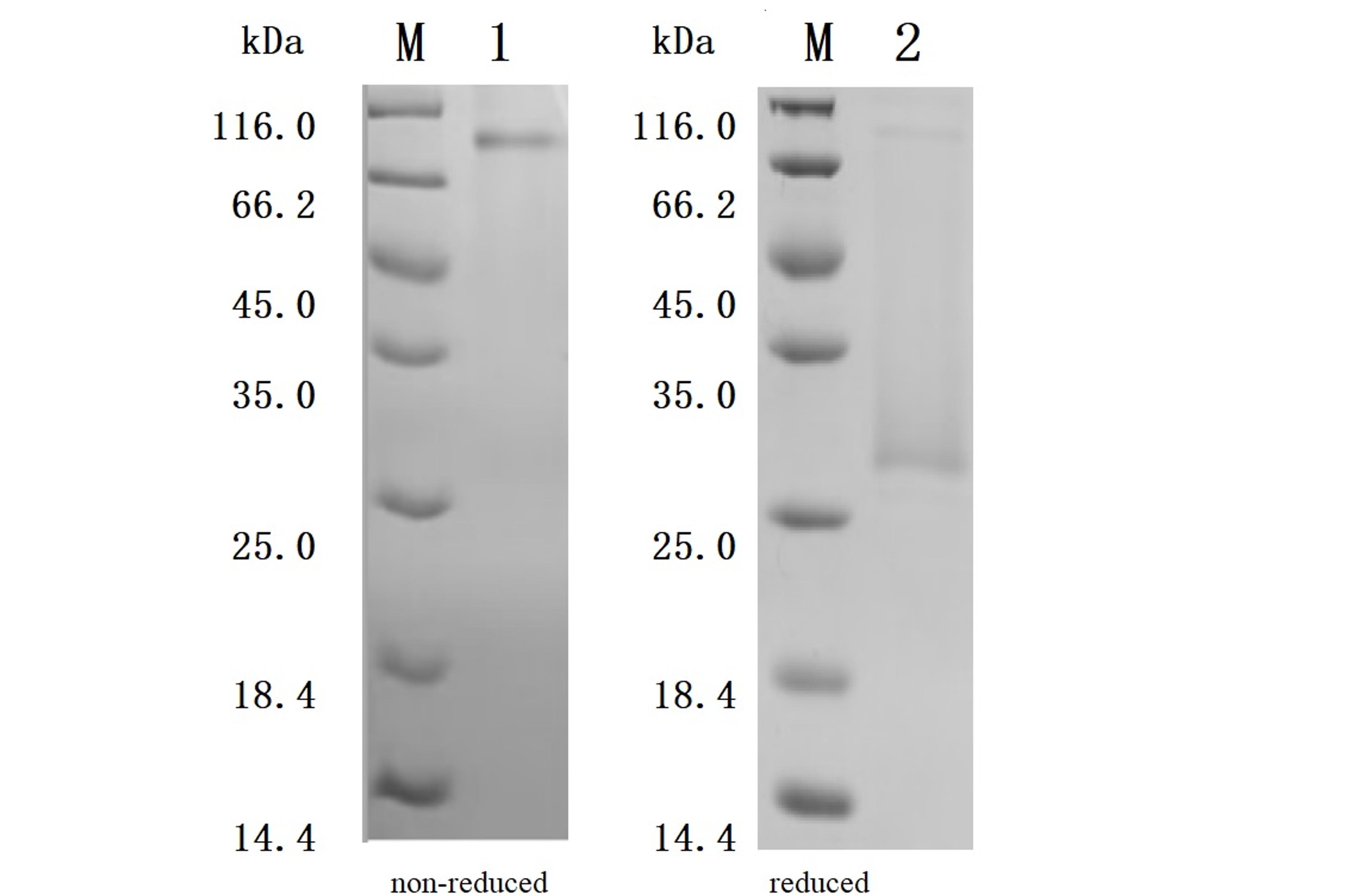 (Tris-Glycine gel) Discontinuous SDS-PAGE (reduced/non-reduced) with 5% enrichment gel and 15% separation gel.
