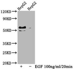 Western Blot. Positive WB detected in HepG2 whole cell lysate(treated with EGF or not). All lanes Phospho-MYC antibody at 0.99μg/ml. Secondary. Goat polyclonal to rabbit IgG at 1/50000 dilution. Predicted band size: 57 KDa. Observed band size: 57 KDa. 