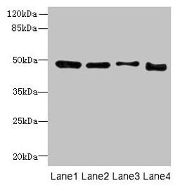 Western blot. All lanes: DDI2 antibody at 4µg/ml. Lane 1: A431 whole cell lysate. Lane 2: HL60 whole cell lysate. Lane 3: K562 whole cell lysate. Lane 4: Caco-2 whole cell lysate. Secondary. Goat polyclonal to rabbit IgG at 1/10000 dilution. Predicted band size: 45, 24, 47 kDa. Observed band size: 47 kDa
