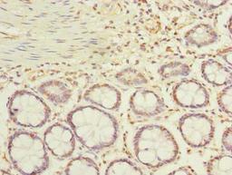 Immunohistochemistry of paraffin-embedded human colon tissue using CSB-PA001255LA01HU at dilution of 1:100