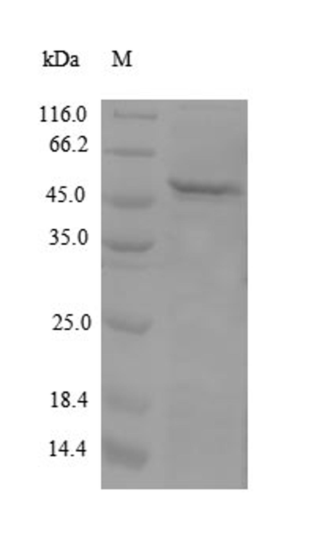 (Tris-Glycine gel) Discontinuous SDS-PAGE (reduced) with 5% enrichment gel and 15% separation gel.