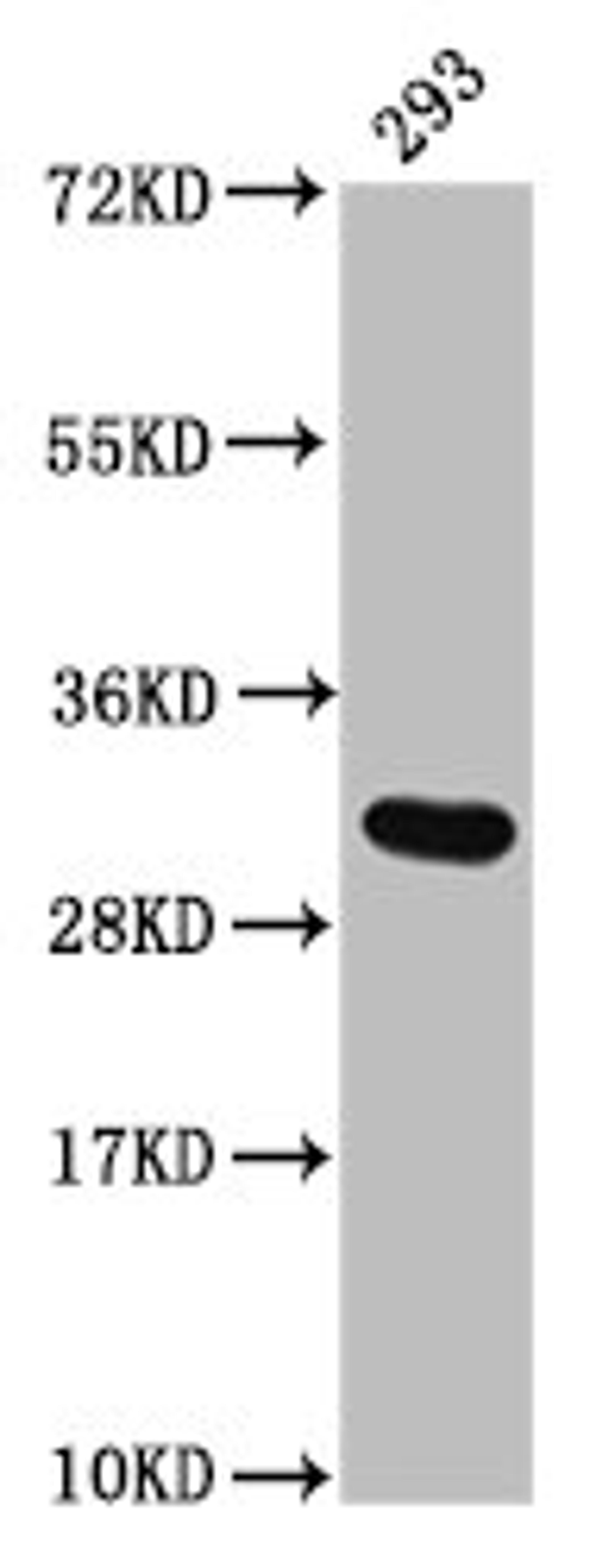 Western Blot. Positive WB detected in: 293 whole cell lysate. All lanes: HIST1H2AG antibody at 1.2µg/ml. Secondary. Goat polyclonal to rabbit IgG at 1/50000 dilution. Predicted band size: 15 kDa. Observed band size: 32 kDa