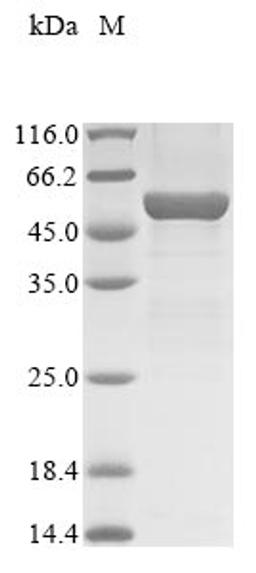 (Tris-Glycine gel) Discontinuous SDS-PAGE (reduced) with 5% enrichment gel and 15% separation gel.