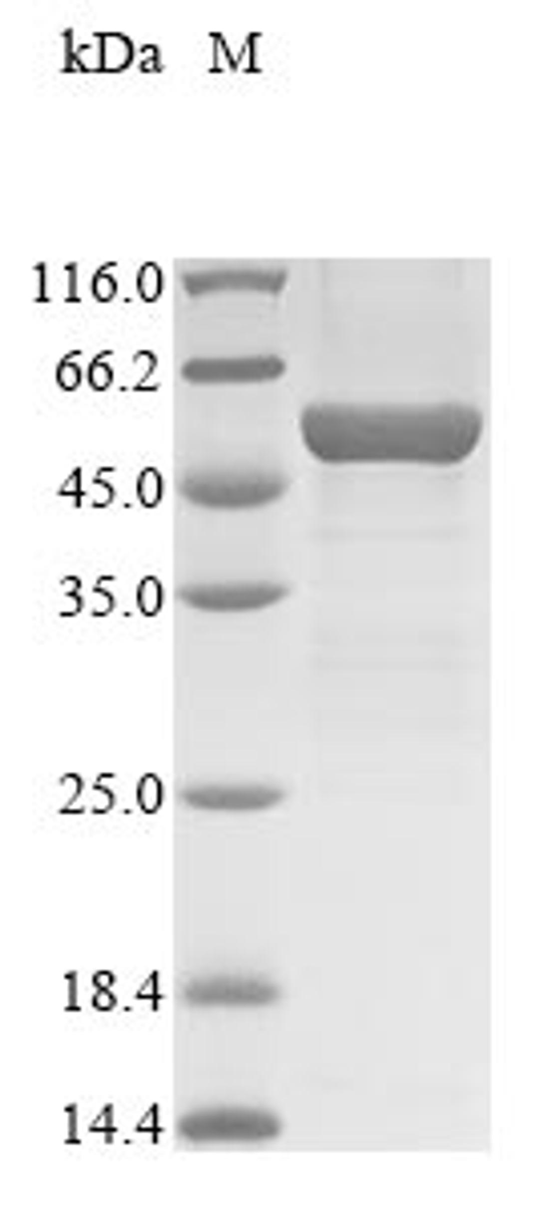 (Tris-Glycine gel) Discontinuous SDS-PAGE (reduced) with 5% enrichment gel and 15% separation gel.