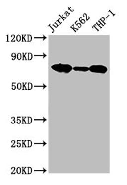 Western Blot. Positive WB detected in: Jurkat whole cell lysate, K562 whole cell lysate, THP-1 whole cell lysate. All lanes: LCP1 antibody at 2.6µg/ml. Secondary. Goat polyclonal to rabbit IgG at 1/50000 dilution. Predicted band size: 71, 22 kDa. Observed band size: 71 kDa