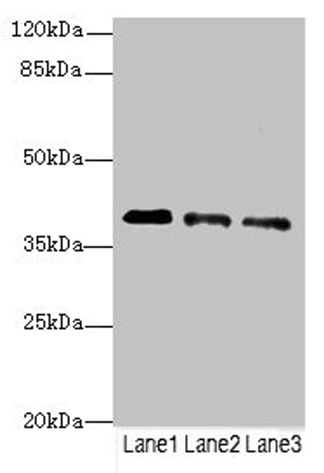 Western blot. All lanes: RP2antibody at 3.81ug/ml. Lane 1: Jurkat whole cell lysate. Lane 2: HepG2 whole cell lysate. Lane 3: Hela whole cell lysate. Secondary. Goat polyclonal to rabbit IgG at 1/10000 dilution. Predicted band size: 40 kDa. Observed band size: 40 kDa. 