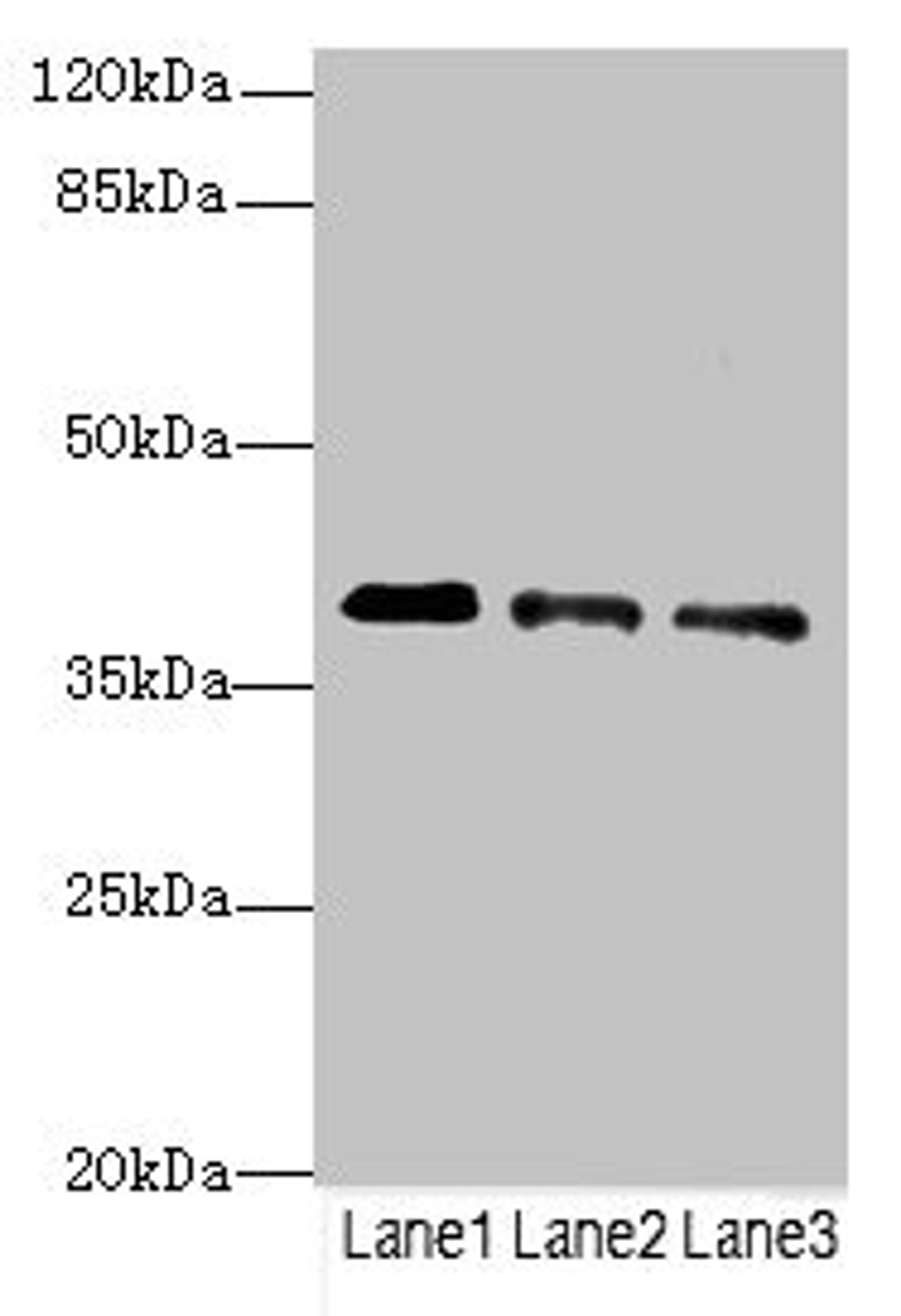 Western blot. All lanes: RP2antibody at 3.81ug/ml. Lane 1: Jurkat whole cell lysate. Lane 2: HepG2 whole cell lysate. Lane 3: Hela whole cell lysate. Secondary. Goat polyclonal to rabbit IgG at 1/10000 dilution. Predicted band size: 40 kDa. Observed band size: 40 kDa. 