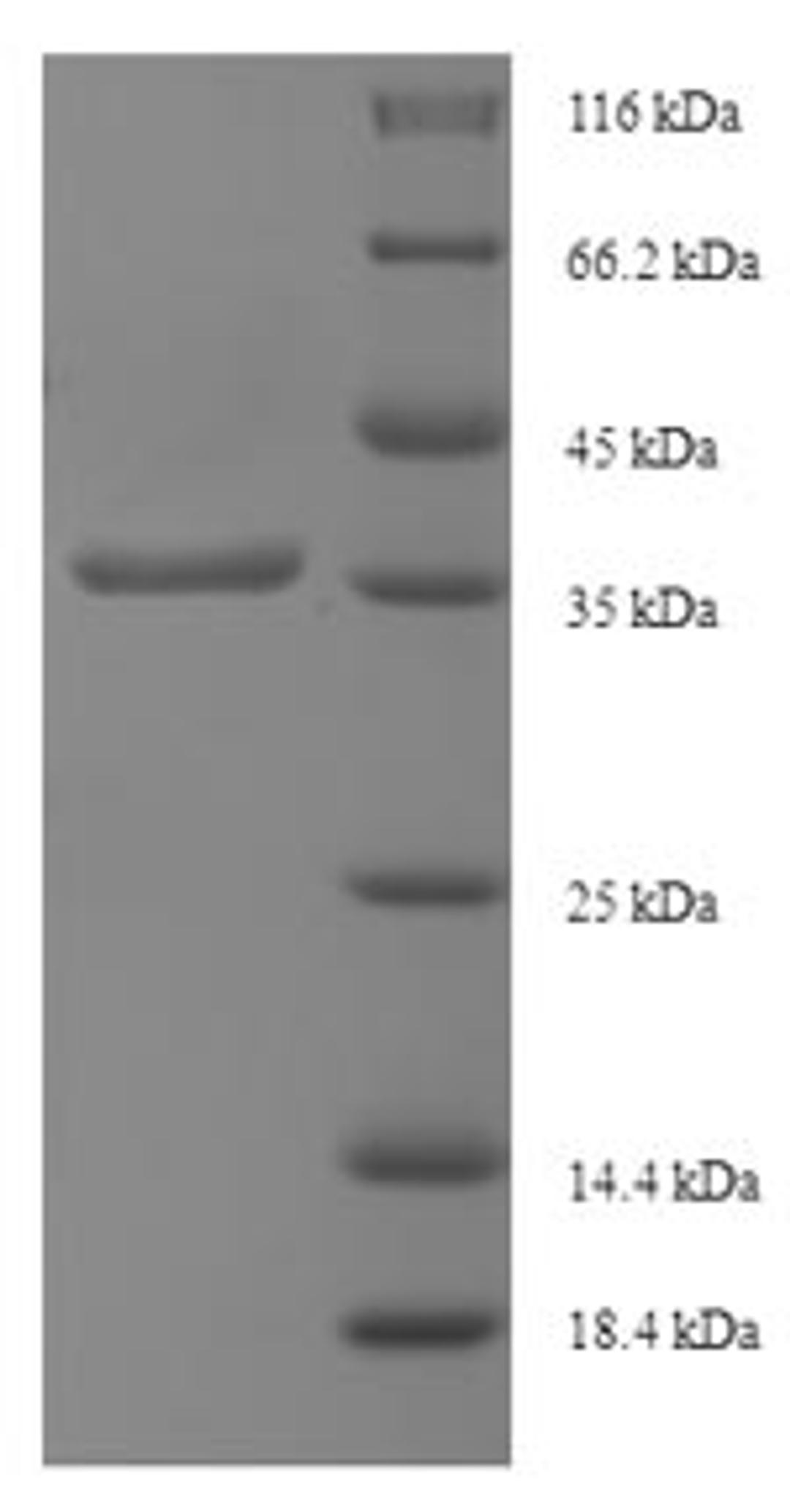 (Tris-Glycine gel) Discontinuous SDS-PAGE (reduced) with 5% enrichment gel and 15% separation gel.