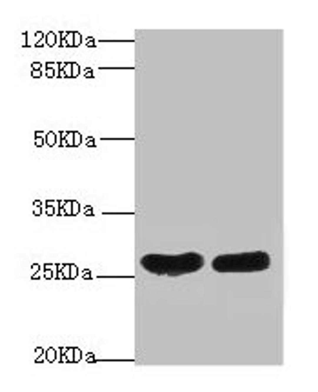 Western blot. All lanes: CRP antibody at 2µg/ml. Lane 1: High values of serum at 1: 5. Lane 2: High values of serum at 1: 10. Secondary. Goat polyclonal to rabbit IgG at 1/10000 dilution. Predicted band size: 26, 11 kDa. Observed band size: 26 kDa