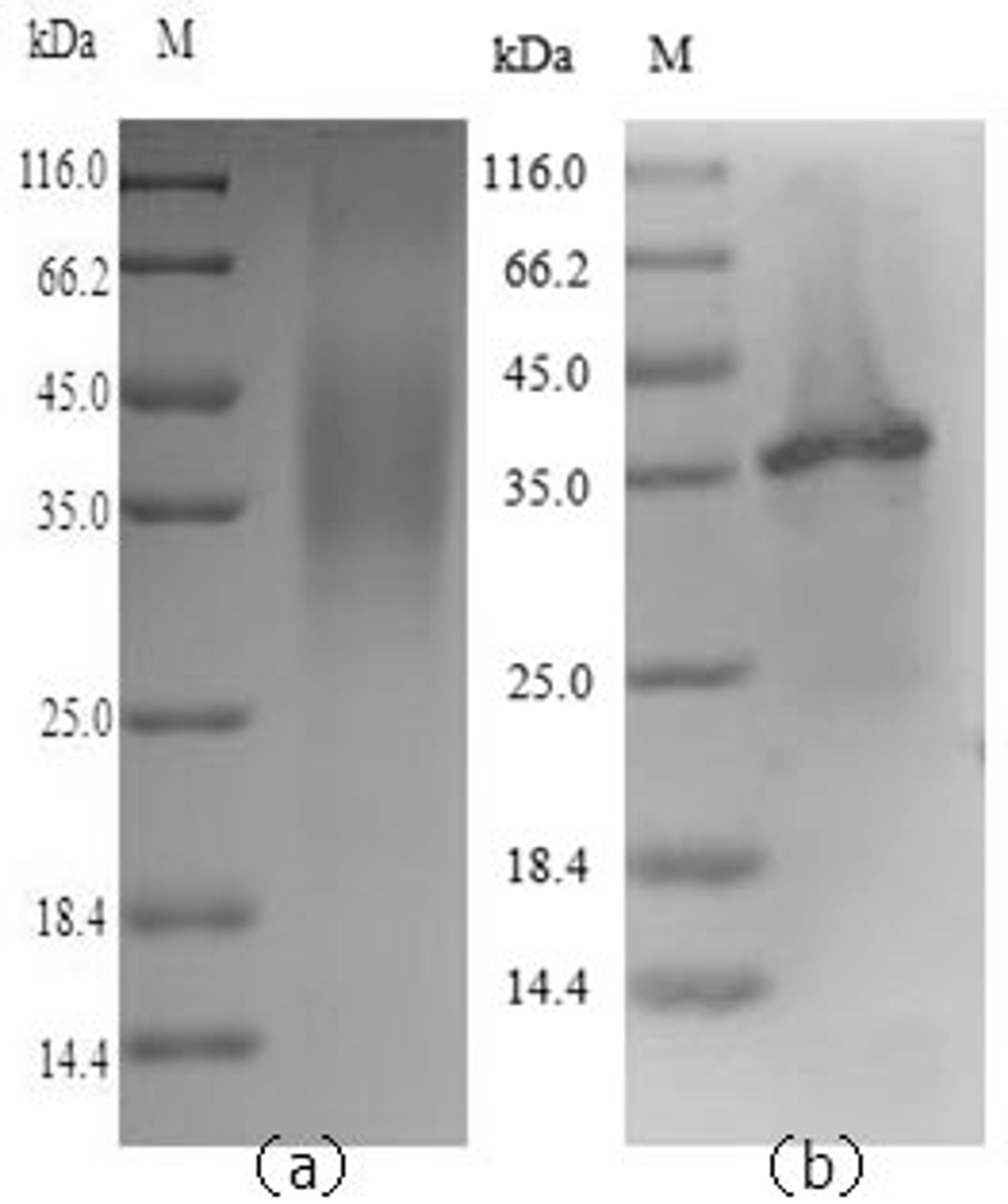 (Tris-Glycine gel) Discontinuous SDS-PAGE (reduced) with 5% enrichment gel and 15% separation gel.