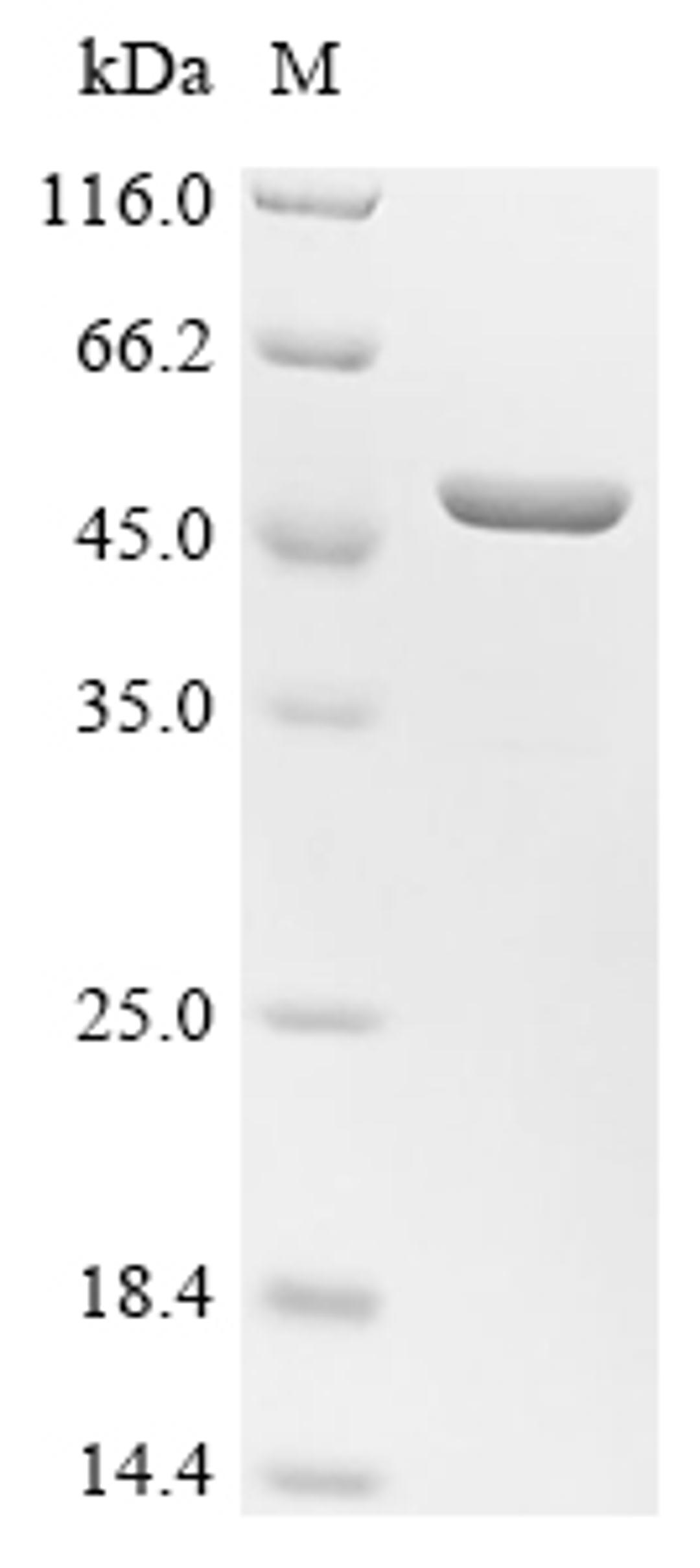 (Tris-Glycine gel) Discontinuous SDS-PAGE (reduced) with 5% enrichment gel and 15% separation gel.