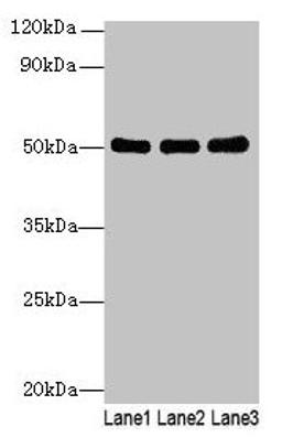 Western blot. All lanes: SIGLEC6 antibody at 6µg/ml. Lane 1: Human high value serum. Lane 2: A549 whole cell lysate. Lane 3: Caco-2 whole cell lysate. Secondary. Goat polyclonal to rabbit IgG at 1/10000 dilution. Predicted band size: 50, 39, 49, 38, 43, 45 kDa. Observed band size: 50 kDa
