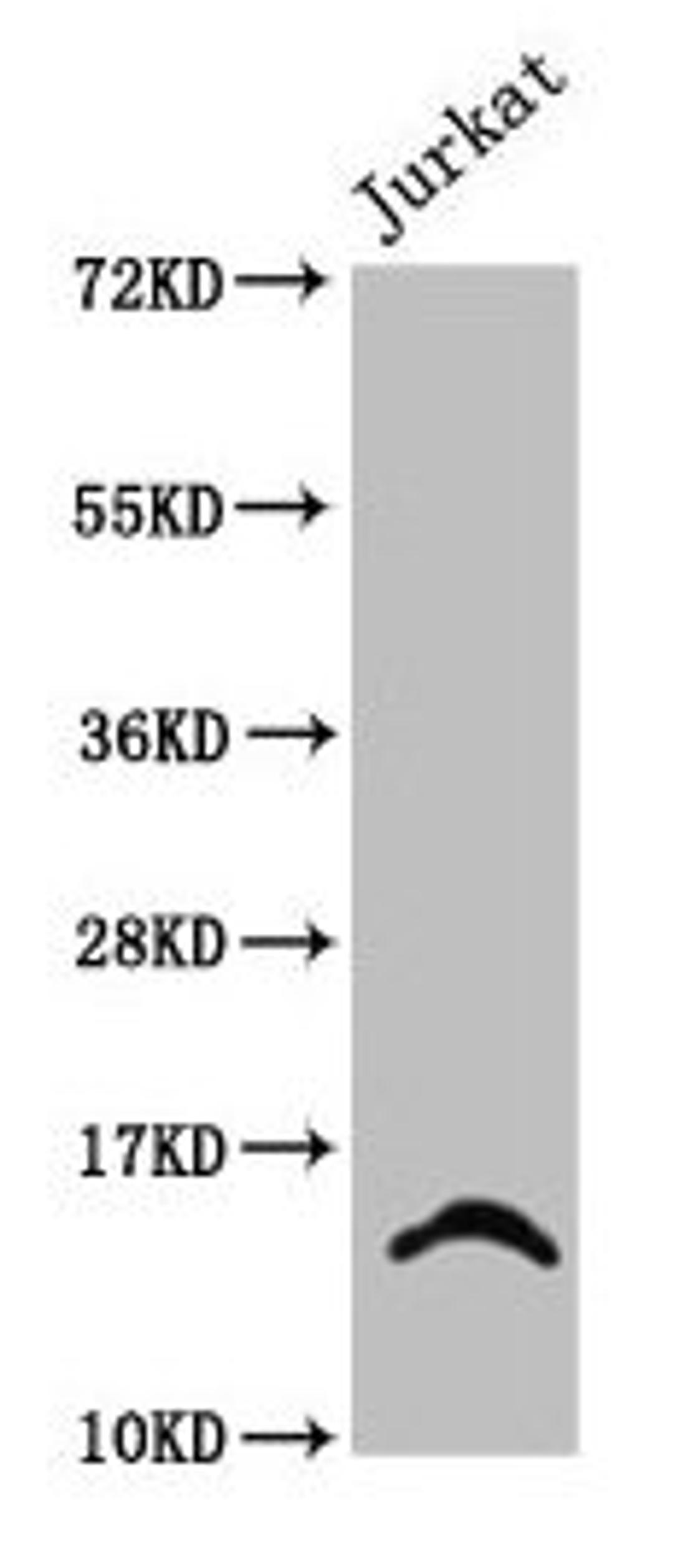 Western Blot. Positive WB detected in: Jurkat whole cell lysate (treated with 30mM sodium butyrate for 4h). All lanes: HIST1H2BC antibody at 2.4µg/ml. Secondary. Goat polyclonal to rabbit IgG at 1/50000 dilution. Predicted band size: 14 kDa. Observed band size: 14 kDa