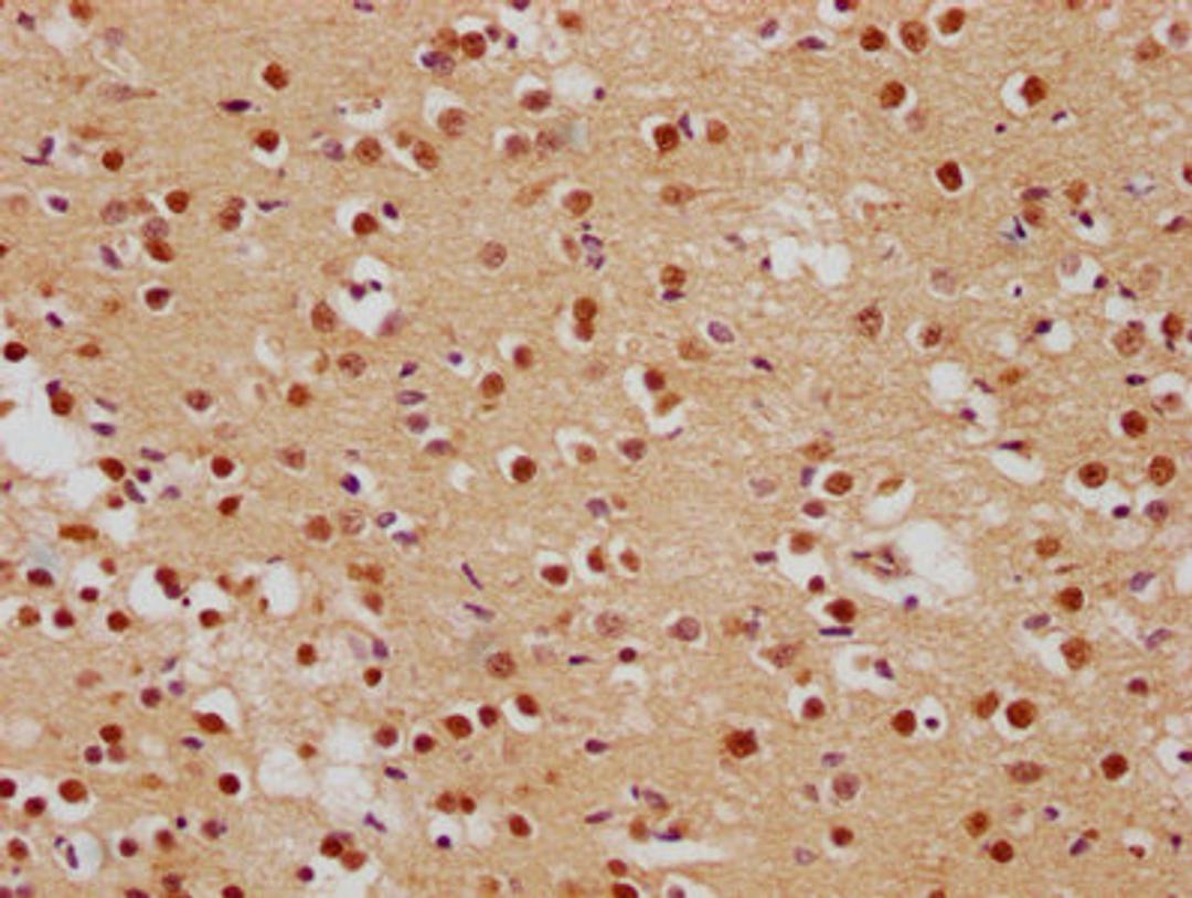 IHC image of CSB-PA008840OA01HU diluted at 1:500 and staining in paraffin-embedded human brain tissue performed on a Leica BondTM system. After dewaxing and hydration, antigen retrieval was mediated by high pressure in a citrate buffer (pH 6.0). Section was blocked with 10% normal goat serum 30min at RT. Then primary antibody (1% BSA) was incubated at 4°C overnight. The primary is detected by a biotinylated secondary antibody and visualized using an HRP conjugated SP system.
