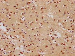 IHC image of CSB-PA008840OA01HU diluted at 1:500 and staining in paraffin-embedded human brain tissue performed on a Leica BondTM system. After dewaxing and hydration, antigen retrieval was mediated by high pressure in a citrate buffer (pH 6.0). Section was blocked with 10% normal goat serum 30min at RT. Then primary antibody (1% BSA) was incubated at 4°C overnight. The primary is detected by a biotinylated secondary antibody and visualized using an HRP conjugated SP system.