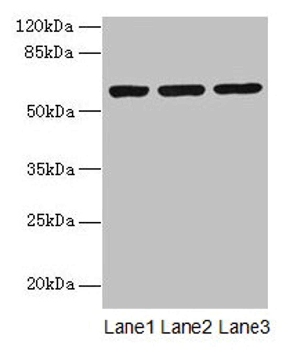 Western blot. All lanes: MIER2 antibody at 4µg/ml. Lane 1: Jurkat whole cell lysate. Lane 2: HepG2 whole cell lysate. Lane 3: A549 whole cell lysate. Secondary. Goat polyclonal to rabbit IgG at 1/10000 dilution. Predicted band size: 60 kDa. Observed band size: 60 kDa