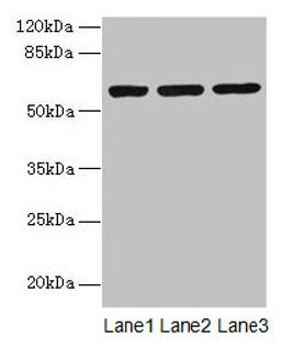 Western blot. All lanes: MIER2 antibody at 4µg/ml. Lane 1: Jurkat whole cell lysate. Lane 2: HepG2 whole cell lysate. Lane 3: A549 whole cell lysate. Secondary. Goat polyclonal to rabbit IgG at 1/10000 dilution. Predicted band size: 60 kDa. Observed band size: 60 kDa
