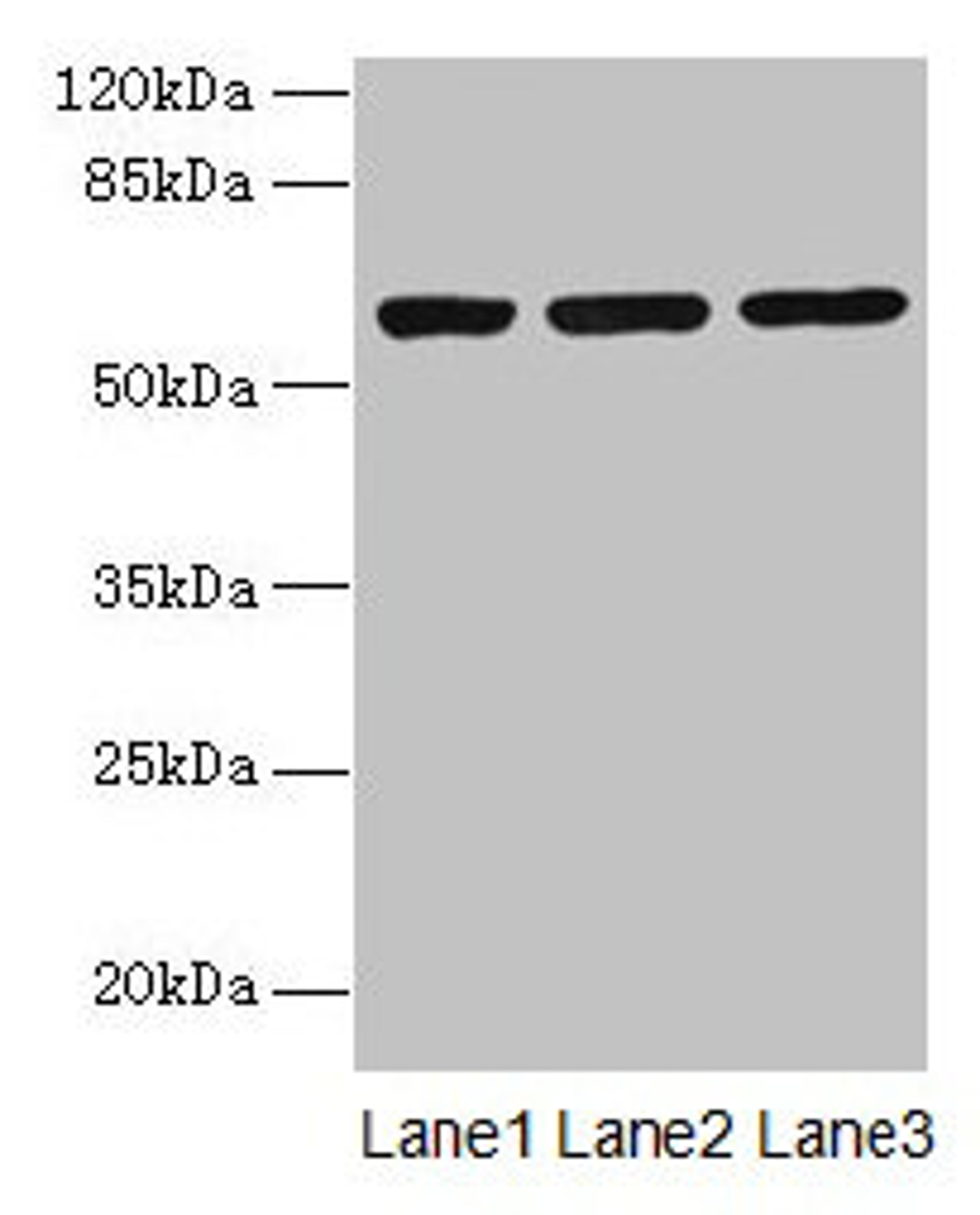Western blot. All lanes: MIER2 antibody at 4µg/ml. Lane 1: Jurkat whole cell lysate. Lane 2: HepG2 whole cell lysate. Lane 3: A549 whole cell lysate. Secondary. Goat polyclonal to rabbit IgG at 1/10000 dilution. Predicted band size: 60 kDa. Observed band size: 60 kDa