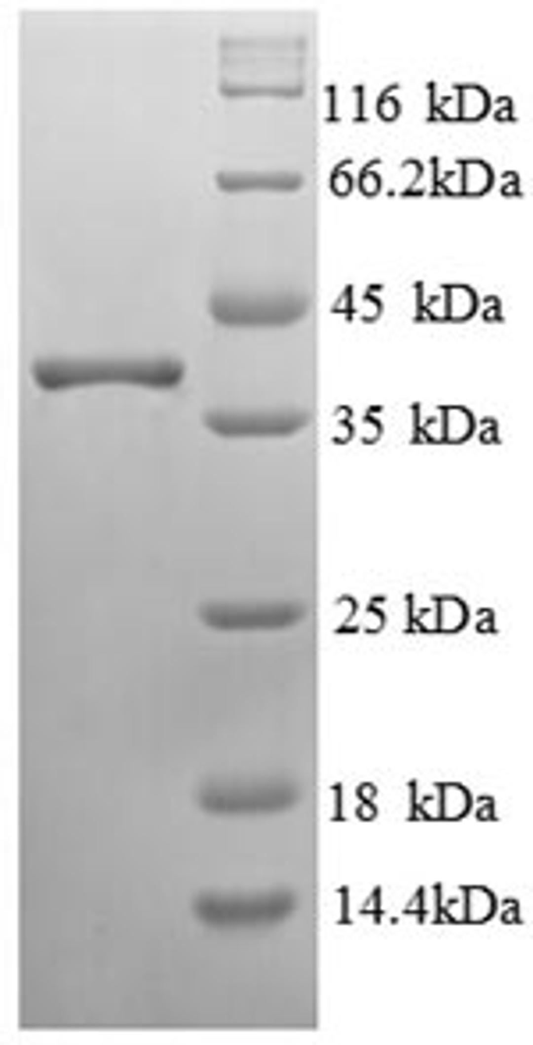 (Tris-Glycine gel) Discontinuous SDS-PAGE (reduced) with 5% enrichment gel and 15% separation gel.