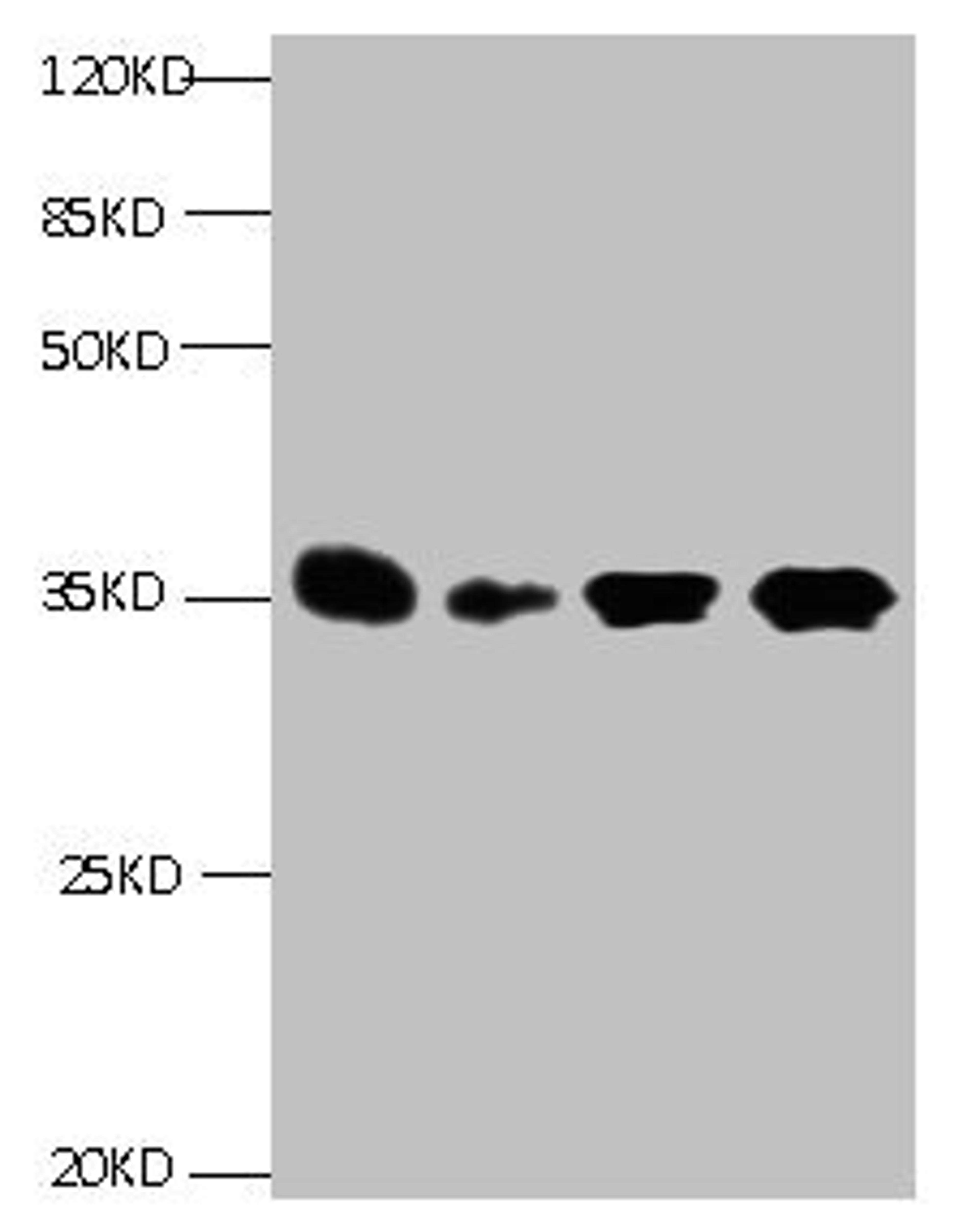 All lanes: Mouse anti- Human Insulin-like growth factor-binding protein 1 monoclonal antibody at 1ug/ml. Lane 1:Pyrolysis liquid human placental tissue 7.5ug/ml. Lane 2:Pyrolysis liquid human placental tissue 3.25ug/ml. Lane 3:IGFBP1 transfected SF9 cell lysate. Lane 4:human amniotic fluid. Secondary Goat polyclonal to Mouse IgG at 1/5000 dilution. Predicted band size : 28kd. Observed band size : 35kd. 