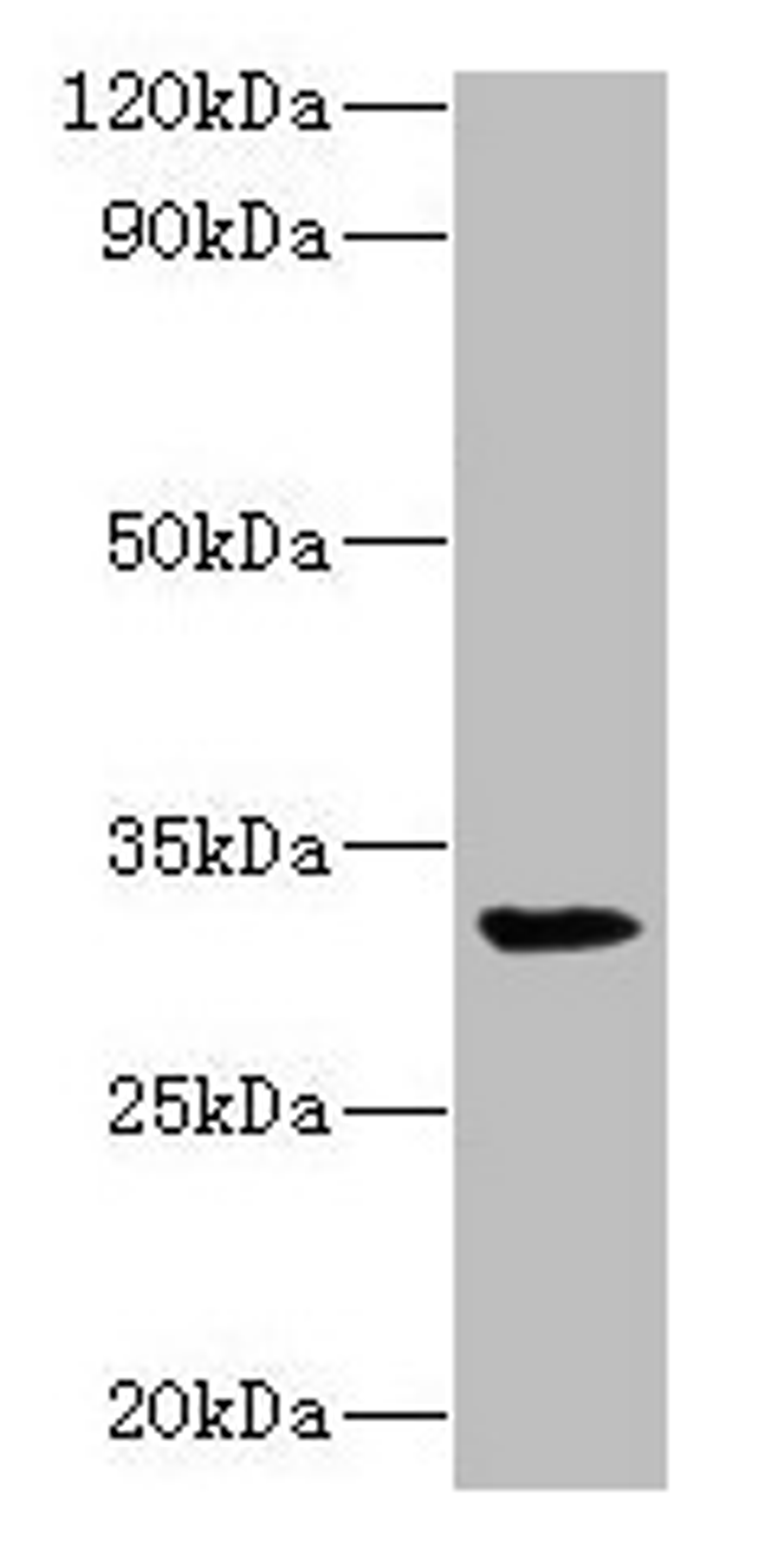 Western blot. All lanes: RPSA antibody at 2µg/ml + Mouse small intestine tissue. Secondary. Goat polyclonal to rabbit lgG at 1/15000 dilution. Predicted band size: 33 kDa. Observed band size: 33 kDa