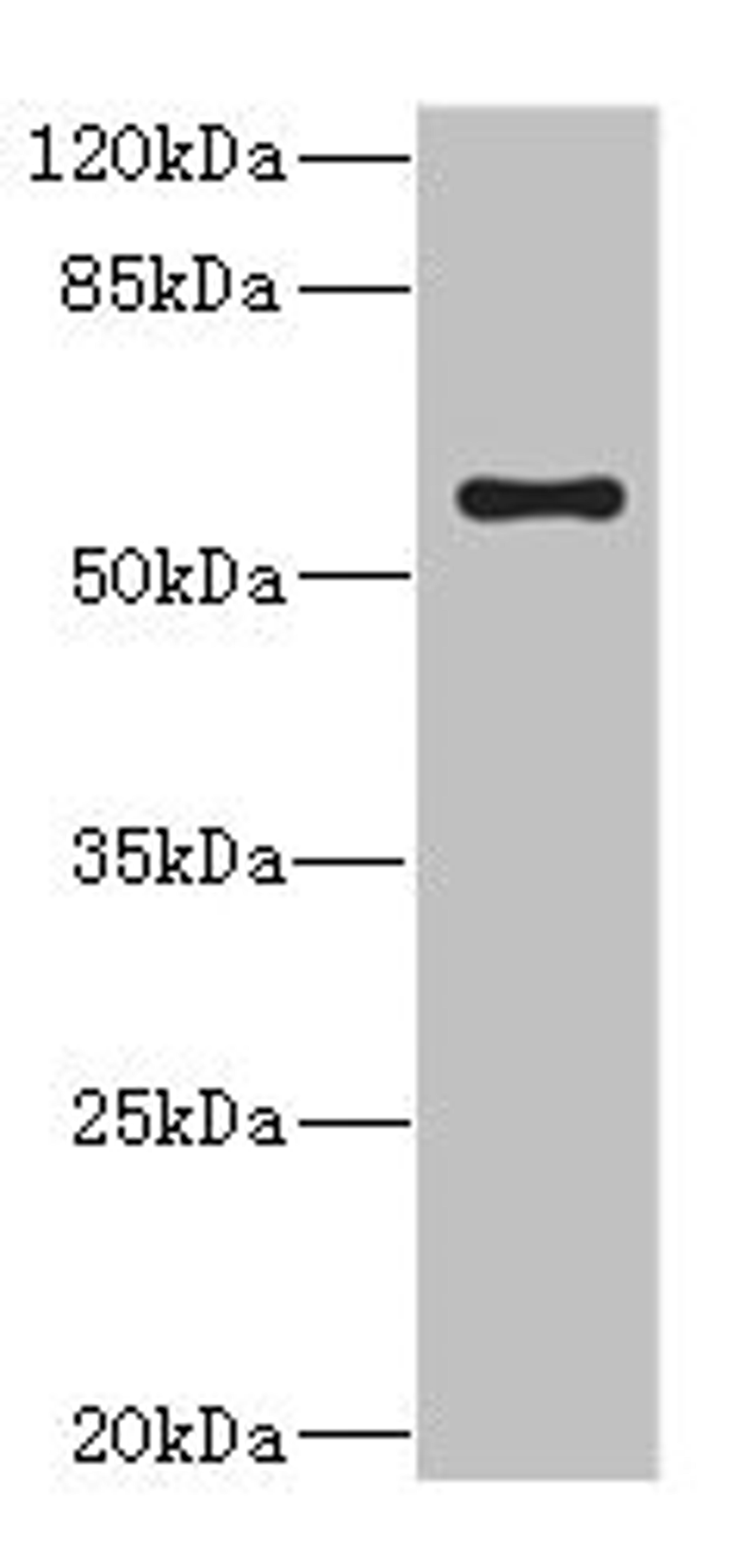Western blot. All lanes: CYP4V2 antibody at 0.85µg/ml + Jurkat whole cell lysate. Secondary. Goat polyclonal to rabbit IgG at 1/10000 dilution. Predicted band size: 61, 59 kDa. Observed band size: 61 kDa
