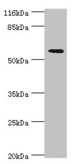 Western blot. All lanes: ACBD5 antibody at 2µg/ml + Hela whole cell lysate. Secondary. Goat polyclonal to rabbit IgG at 1/10000 dilution. Predicted band size: 61, 55, 59, 47 kDa. Observed band size: 61 kDa