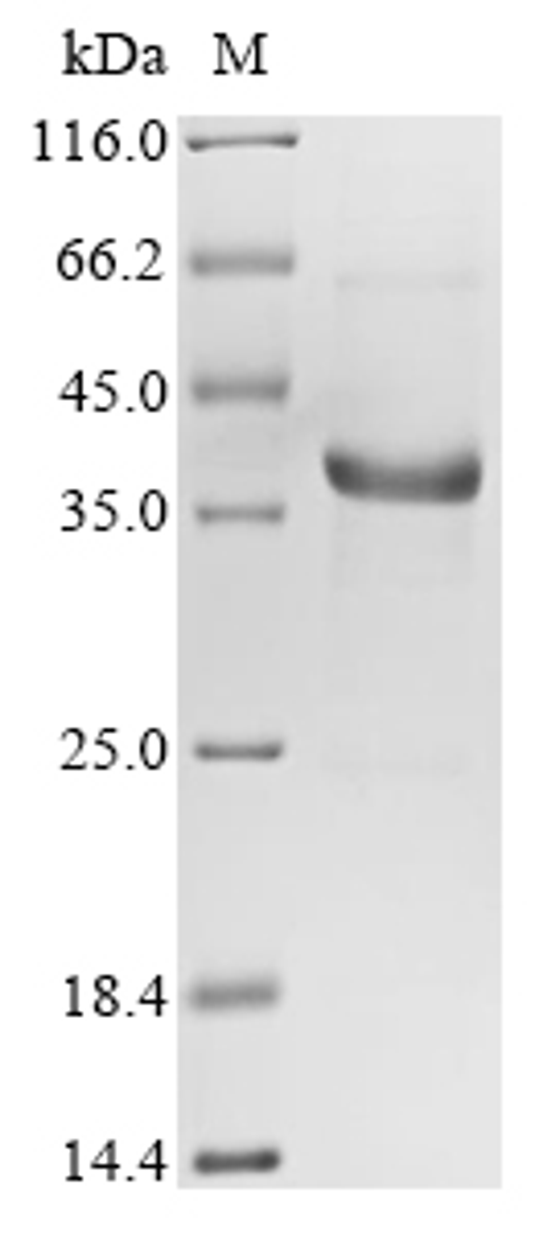 (Tris-Glycine gel) Discontinuous SDS-PAGE (reduced) with 5% enrichment gel and 15% separation gel.