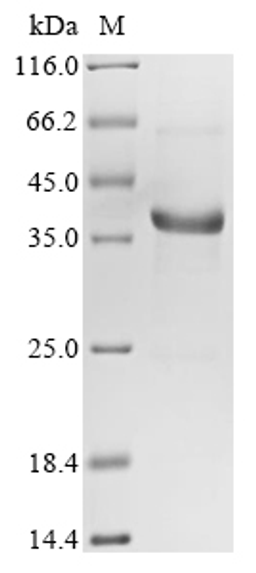 (Tris-Glycine gel) Discontinuous SDS-PAGE (reduced) with 5% enrichment gel and 15% separation gel.