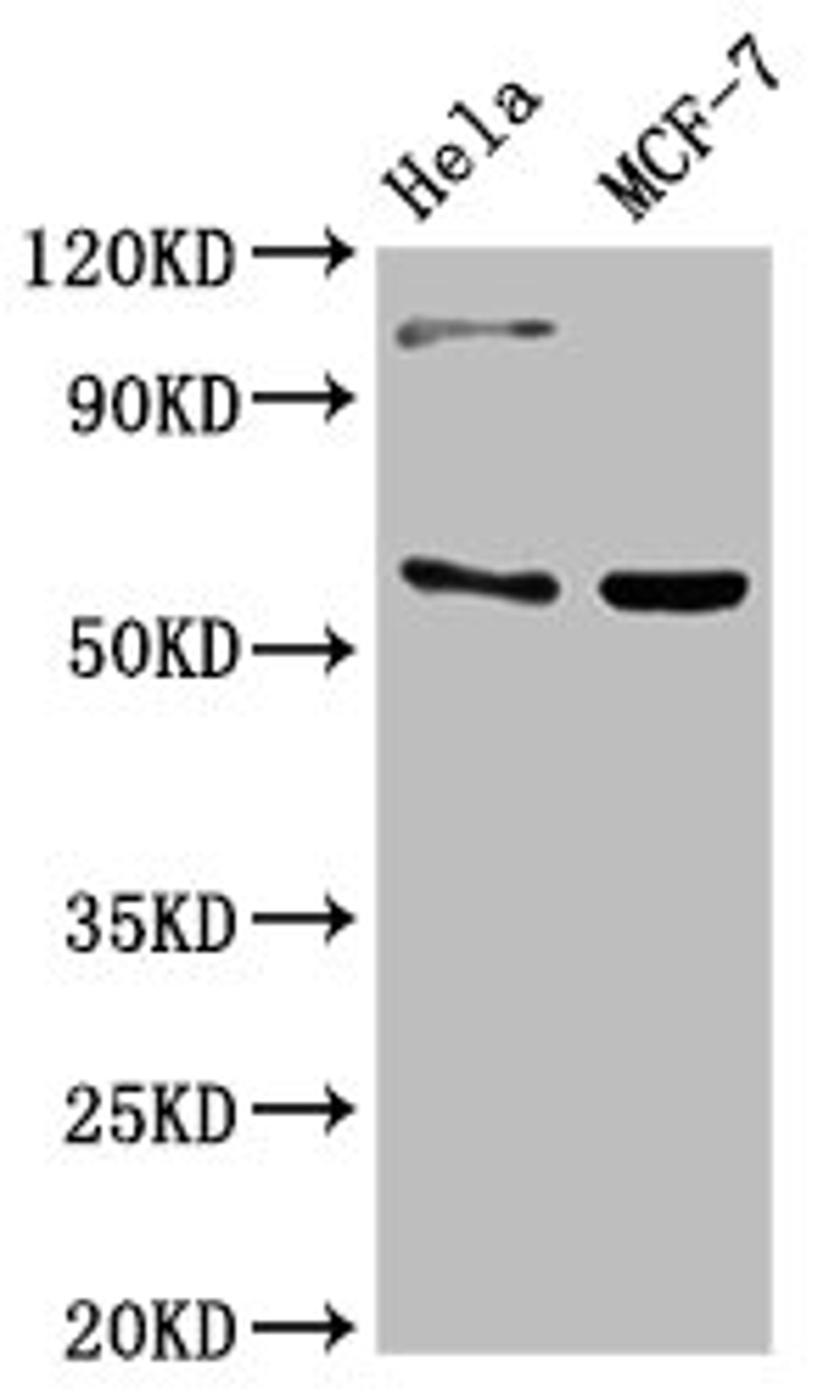 Western Blot. Positive WB detected in: Hela whole cell lysate, MCF-7 whole cell lysate. All lanes: RUNX2 antibody at 3ug/ml. Secondary. Goat polyclonal to rabbit IgG at 1/50000 dilution. Predicted band size: 57, 56, 55 kDa. Observed band size: 57 kDa. 