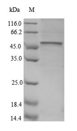(Tris-Glycine gel) Discontinuous SDS-PAGE (reduced) with 5% enrichment gel and 15% separation gel.