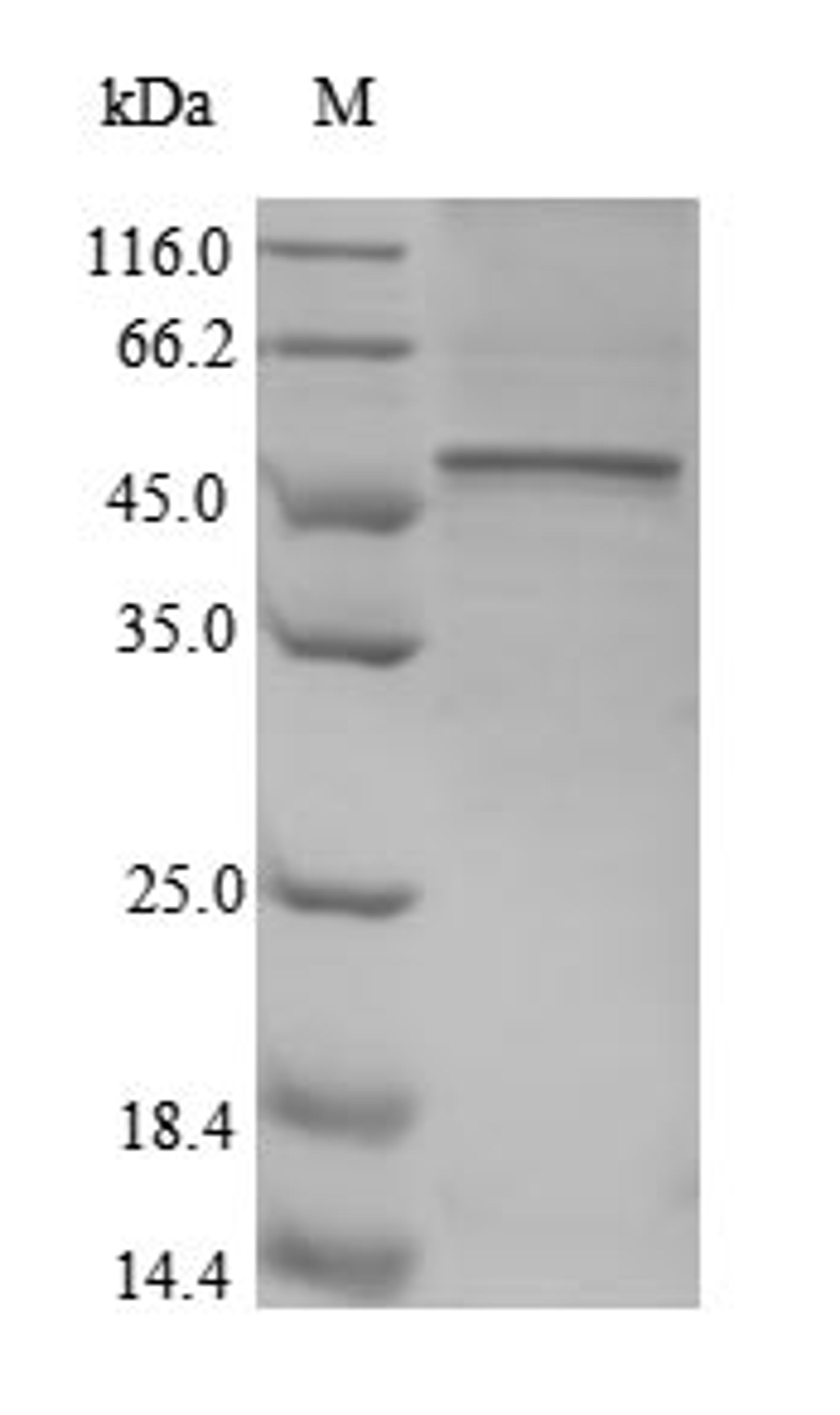 (Tris-Glycine gel) Discontinuous SDS-PAGE (reduced) with 5% enrichment gel and 15% separation gel.