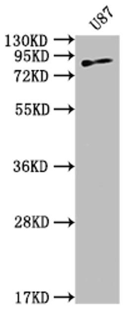 Western Blot. Positive WB detected in: U87 whole cell lysate. All lanes: TGM2 antibody at 1:2000. Secondary. Goat polyclonal to rabbit IgG at 1/50000 dilution. Predicted band size: 78, 62, 39 kDa. Observed band size: 78 kDa. 